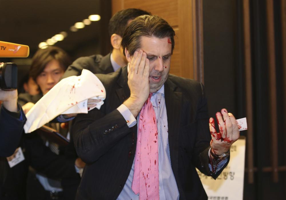 U.S. Ambassador to South Korea Lippert leaves after he was slashed in the face by an unidentified assailant at a public forum in central Seoul