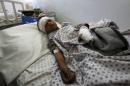 An injured boy receives treatment in a hospital after a suicide attack in Asadabad, capital of Kunar province, Afghanistan