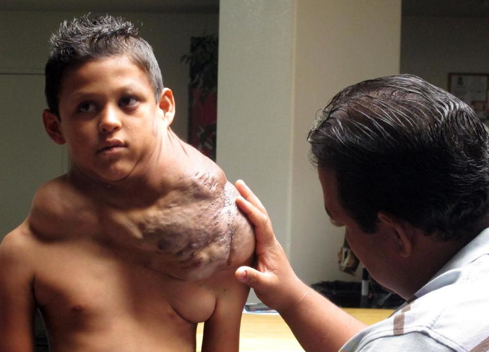 FILE - In this July 20, 2012 file photo, the father of a Ciudad Juarez-born boy suffering from a massive tumor who U.S. Homeland Security identified...