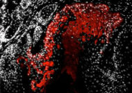 Malas noticias: las células madre podrían activar el crecimiento de los tumores Cel_madres