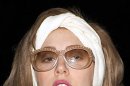 Lady Gaga Jalani Operasi Pinggul