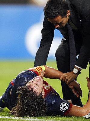 إصابة قائد فريق برشلونة كارليس بويول بخلع في المرفق في لقاء الذهاب مع فريق  بنفيكا بدور المجموعات بدوري أبطال أوروبا 2012-2013 .