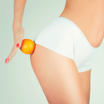 La piel de naranja, pesadilla de muchas / Foto: Thinkstock