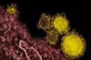FILE - This undated electron microscope image made available by the National Institute of Allergy and Infectious Diseases - Rocky Mountain Laboratories shows novel coronavirus particles, also known as the MERS virus, colorized in yellow. On Saturday, May 17, 2014 the U.S. Centers for Disease Control and Prevention said an Illinois man has apparently picked up an infection from the only American diagnosed with a mysterious Middle East virus, but the man has not needed medical treatment. (AP Photo/NIAID - RML, File)