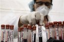 A nurse arranges test tubes containing blood taken during a free HIV test, at an HIV/AIDS awareness rally on World AIDS Day in San Salvador