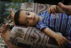 Two and a half-year-old Muhammad Al Masri rests on &hellip;
