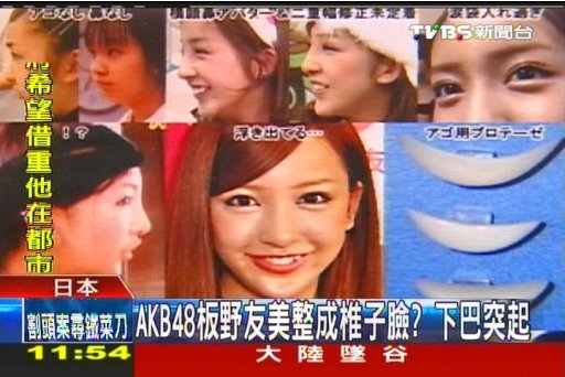 AKB48板野友美整成椎子臉？　下巴突起