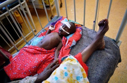 Criança desnutrida no hospital Banadir de Mogadíscio em 24 de abril