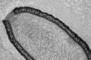 Giant Virus Resurrected from Permafrost After 30,000 Years