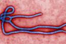FILE - This undated file image made available by the CDC shows the Ebola Virus. U.S. health officials have warned for months that someone infected with Ebola could unknowingly carry the virus to this country, and on Tuesday, Sept. 30, 2014, came word that it had happened: A traveler in a Dallas hospital became the first patient diagnosed in the U.S. (AP Photo/CDC, File)