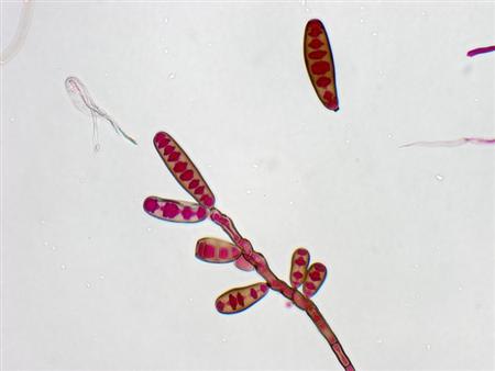 Exserohilum rostratum, a type of fungi, is seen in this handout image from the Centres for Disease Control, October 13, 2012. REUTERS/Centres for Disease Control/Handout