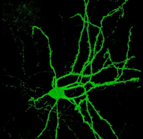 Brain's building block: a spiny neuron.