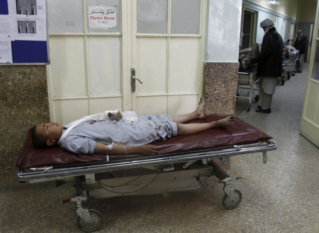 An Afghan boy, who was injured in a suicide attack during a Muharram procession, lies on a bed at a hospital in Kabul, Afghanistan, Tuesday, Dec. 6, 2011. A suicide bomber struck a crowd of Shiite wor