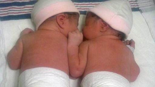 New Year's Twin Babies Born in Separate Years