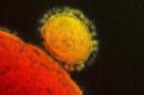 the MERS coronavirus that emerged in 2012