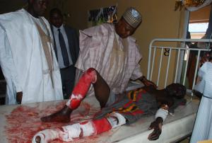 Borno state governor Kashim Shettima, speaks to a victim &hellip;