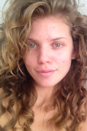 Twitter Is AnnaLynne McCord trying to get herself a Proactiv deal
