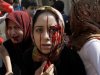 Γυναίκες τραυματισμένες στο Χαλέπι έπειτα από βομβαρδισμό των κυβερνητικών δυνάμεων
