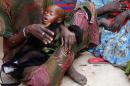 A woman holds her malnourished child in Sirlaabe IDP camp in Mogadishu