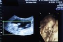 A four dimensional ultrasound is seen at a pregnancy clinic in Arlington Texas