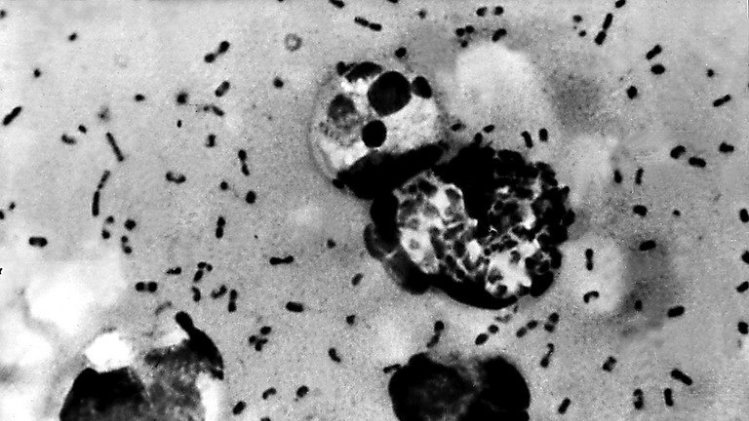 Bubonic plague bacteria from a patient, in a photo obtained on 15 January 2003 from the US Centers For Disease Control
