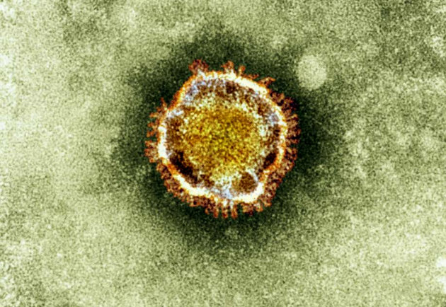 FILE - This undated file image released by the British Health Protection Agency shows an electron microscope image of a coronavirus, part of a family of viruses that cause ailments including the common cold and SARS, which was first identified last year in the Middle East. The Ministry of Health in Saudi Arabia told world health officials that two health care workers became ill this month after being exposed to patients with the a deadly new respiratory virus related to SARS. One is critically ill. (AP Photo/Health Protection Agency, File)