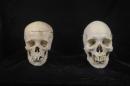 Two human skulls prepared for clinical use that were donated to a Bellevue, Washington thrift store, are pictured in this undated handout photo