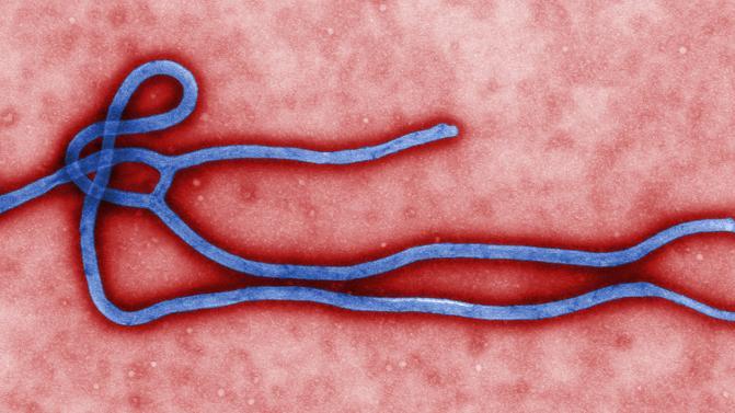 An electron micrograph image of an Ebola virus virion obtained March 24, 2014 from the Centers for Disease Control (CDC) in Atlanta, Georgia