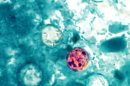In this image provided by the Centers for Disease Control and Prevention, a photomicrograph of a fresh stool sample, which had been prepared using a 10% formalin solution, and stained with modified acid-fast stain, reveals the presence of four Cyclospora cayetanensis oocysts in the field of view. Iowa and Nebraska health officials said Tuesday, July 30, 2013, that a prepackaged salad mix is the source of a cyclospora outbreak that sickened more than 178 people in both states. Cyclospora is a rare parasite that causes a lengthy gastrointestinal illness. (AP Photo/Centerd for Disease Control and Prevention)