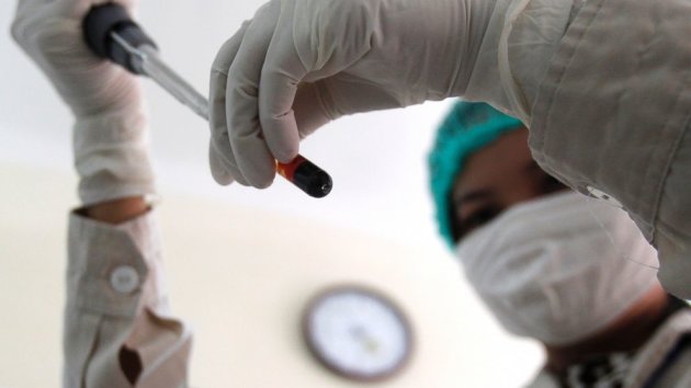 Scientists Find Aggressive New HIV Strain (ABC News)