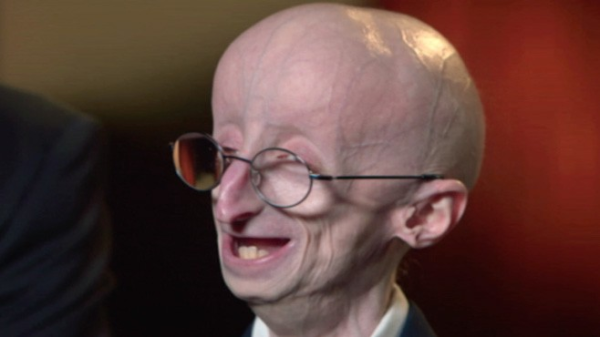 The Triumphant Story of Sam Berns, Progeria and Math | Watch the video