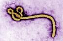 Some of the ultrastructural morphology displayed by an Ebola virus virion is revealed in this undated handout colorized transmission electron micrograph