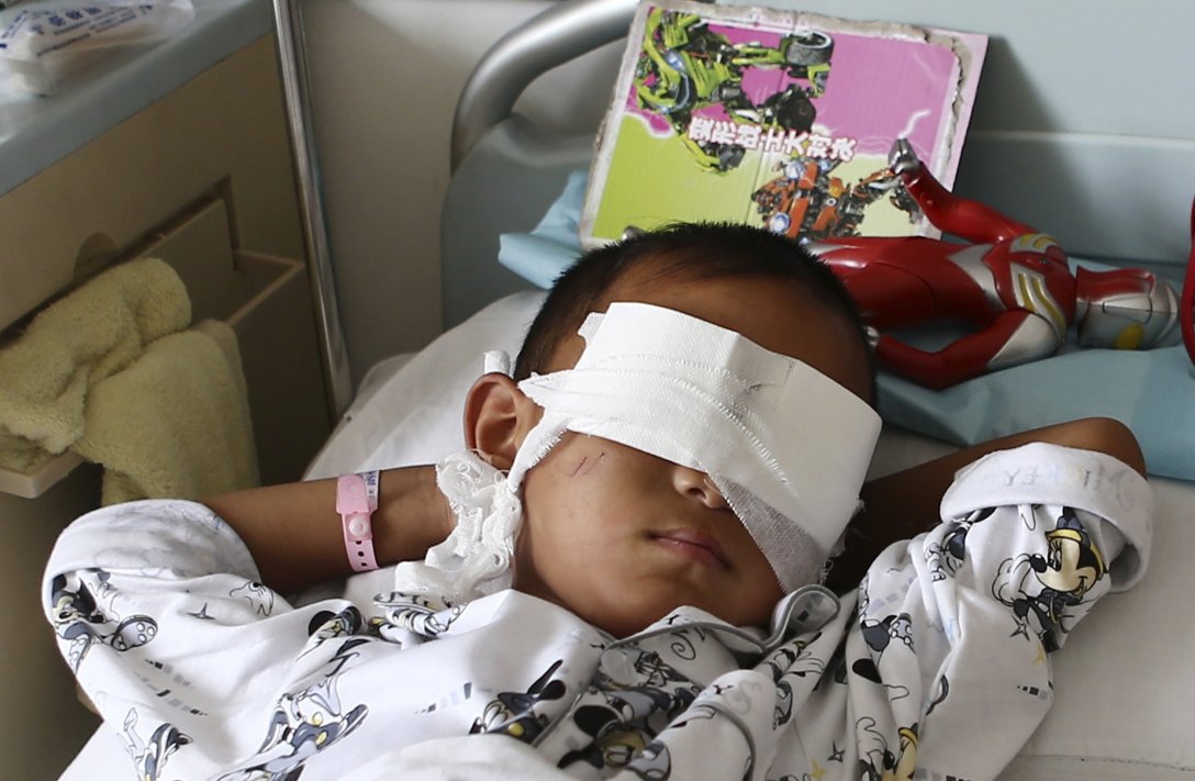 A boy whose eyes were gouged out lies on a hospital bed in Taiyuan
